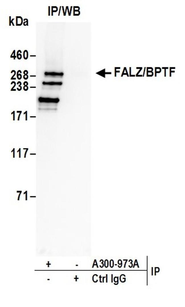 FALZ/BPTF Antibody in Western Blot (WB)