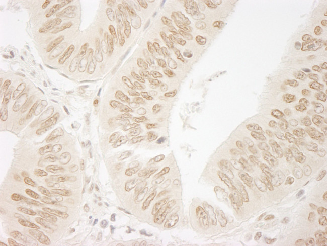 FALZ/BPTF Antibody in Immunohistochemistry (IHC)