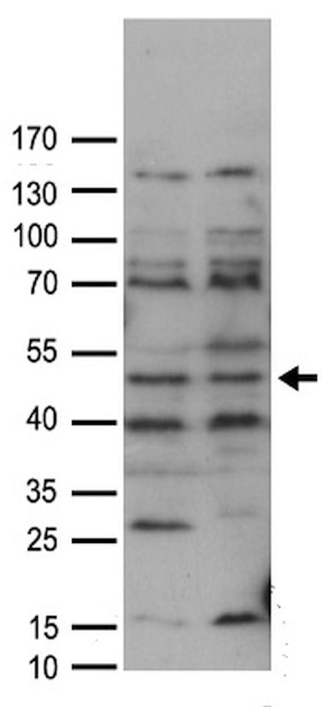 FAM175A Antibody in Western Blot (WB)