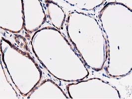 FAM40A Antibody in Immunohistochemistry (Paraffin) (IHC (P))