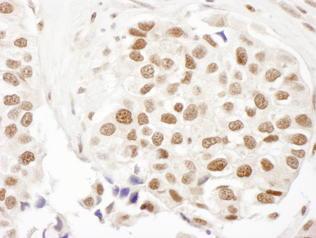 FANCD2 Antibody in Immunohistochemistry (IHC)