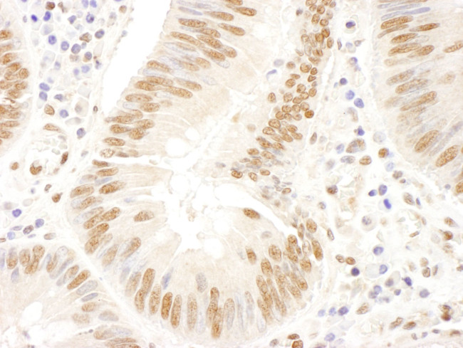 FANCD2 Antibody in Immunohistochemistry (IHC)