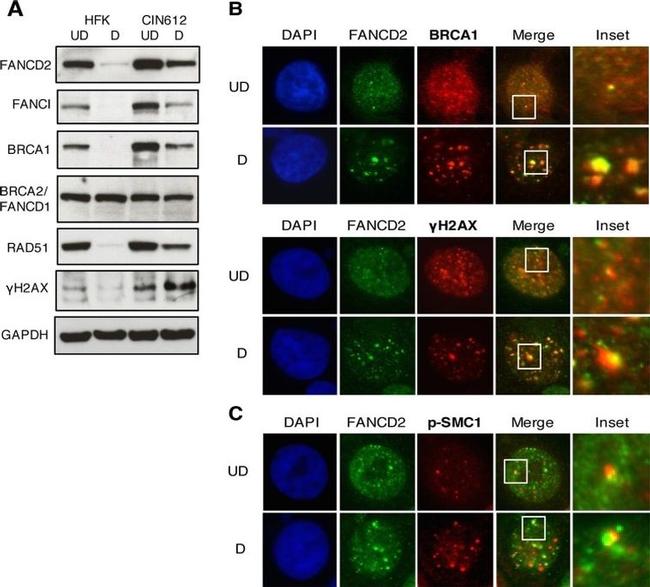 FANCD2 Antibody in Western Blot, Immunocytochemistry (WB, ICC/IF)