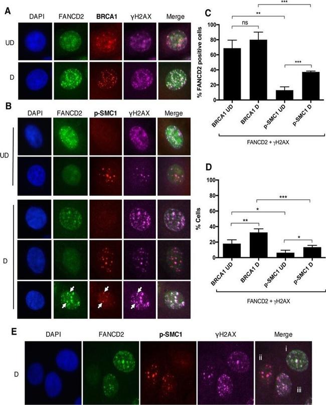 FANCD2 Antibody in Immunocytochemistry (ICC/IF)