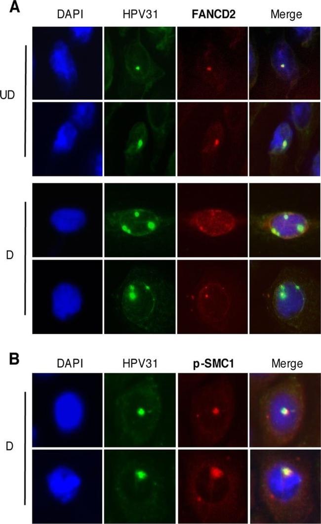 FANCD2 Antibody in Immunocytochemistry (ICC/IF)