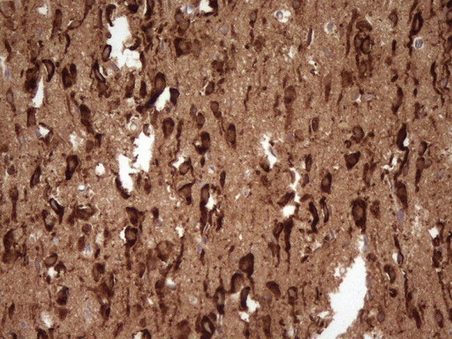 FARSB Antibody in Immunohistochemistry (Paraffin) (IHC (P))