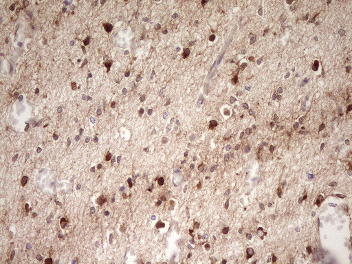 FARSB Antibody in Immunohistochemistry (Paraffin) (IHC (P))