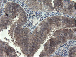 FBXO42 Antibody in Immunohistochemistry (Paraffin) (IHC (P))