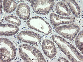 FBXO42 Antibody in Immunohistochemistry (Paraffin) (IHC (P))