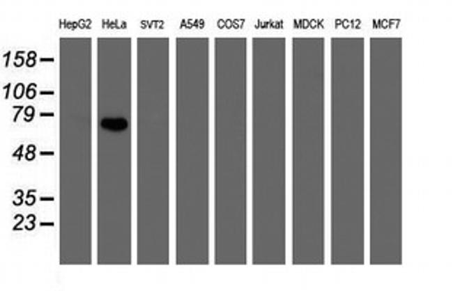 FBXO42 Antibody in Western Blot (WB)