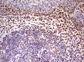 FBXW7 Antibody in Immunohistochemistry (Paraffin) (IHC (P))