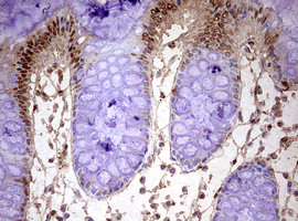 FBXW7 Antibody in Immunohistochemistry (Paraffin) (IHC (P))