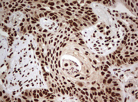 FBXW7 Antibody in Immunohistochemistry (Paraffin) (IHC (P))