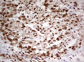 FBXW7 Antibody in Immunohistochemistry (Paraffin) (IHC (P))