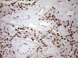 FBXW7 Antibody in Immunohistochemistry (Paraffin) (IHC (P))