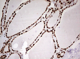 FBXW7 Antibody in Immunohistochemistry (Paraffin) (IHC (P))