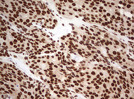 FBXW7 Antibody in Immunohistochemistry (Paraffin) (IHC (P))