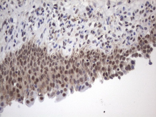 FBXW7 Antibody in Immunohistochemistry (Paraffin) (IHC (P))