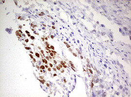 FBXW7 Antibody in Immunohistochemistry (Paraffin) (IHC (P))