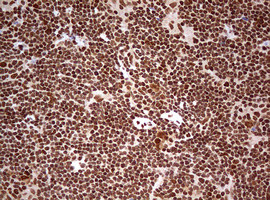 FBXW7 Antibody in Immunohistochemistry (Paraffin) (IHC (P))