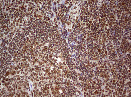 FBXW7 Antibody in Immunohistochemistry (Paraffin) (IHC (P))