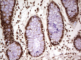 FBXW7 Antibody in Immunohistochemistry (Paraffin) (IHC (P))