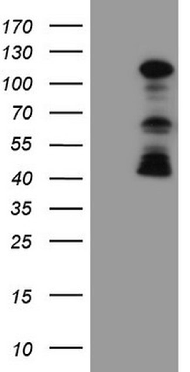 FBXW7 Antibody in Western Blot (WB)