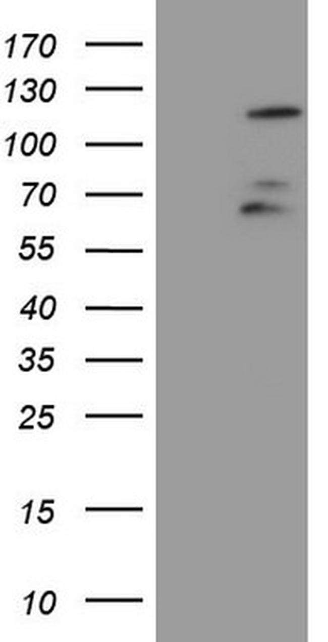 FBXW7 Antibody in Western Blot (WB)