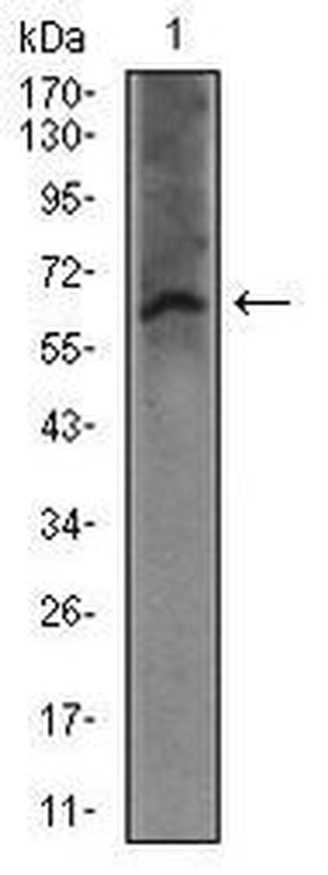 FceR1 alpha Antibody in Western Blot (WB)