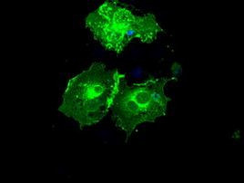 FCGR2A Antibody in Immunocytochemistry (ICC/IF)