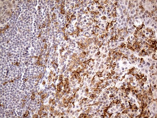 FCGR2A Antibody in Immunohistochemistry (Paraffin) (IHC (P))