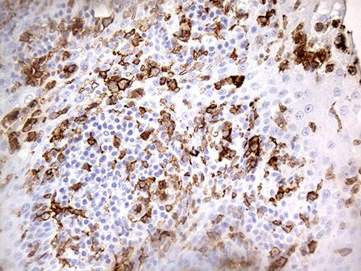 FCGR2A Antibody in Immunohistochemistry (Paraffin) (IHC (P))