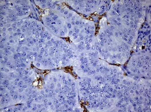 FCGR2A Antibody in Immunohistochemistry (Paraffin) (IHC (P))