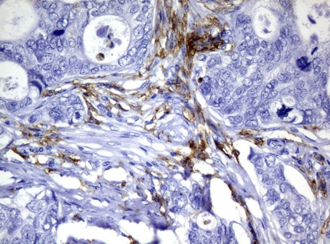 FCGR2A Antibody in Immunohistochemistry (Paraffin) (IHC (P))