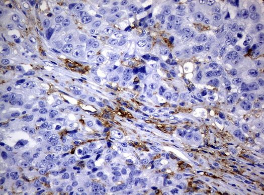 FCGR2A Antibody in Immunohistochemistry (Paraffin) (IHC (P))