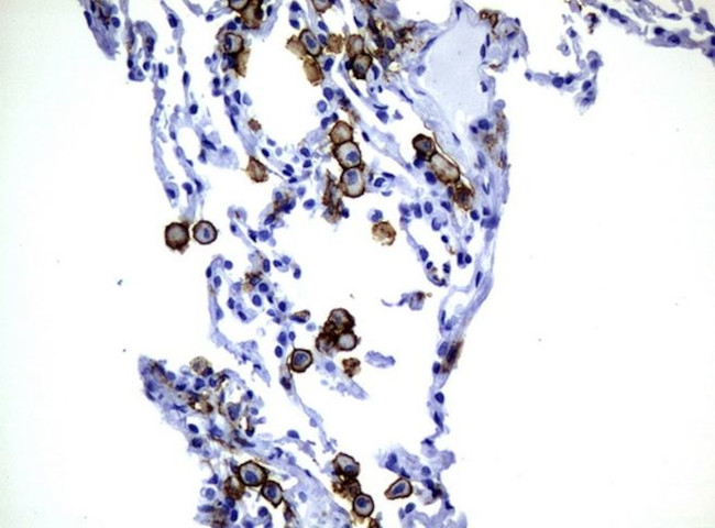 FCGR2A Antibody in Immunohistochemistry (Paraffin) (IHC (P))