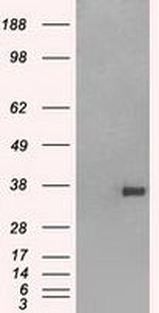 FCGR2A Antibody in Western Blot (WB)