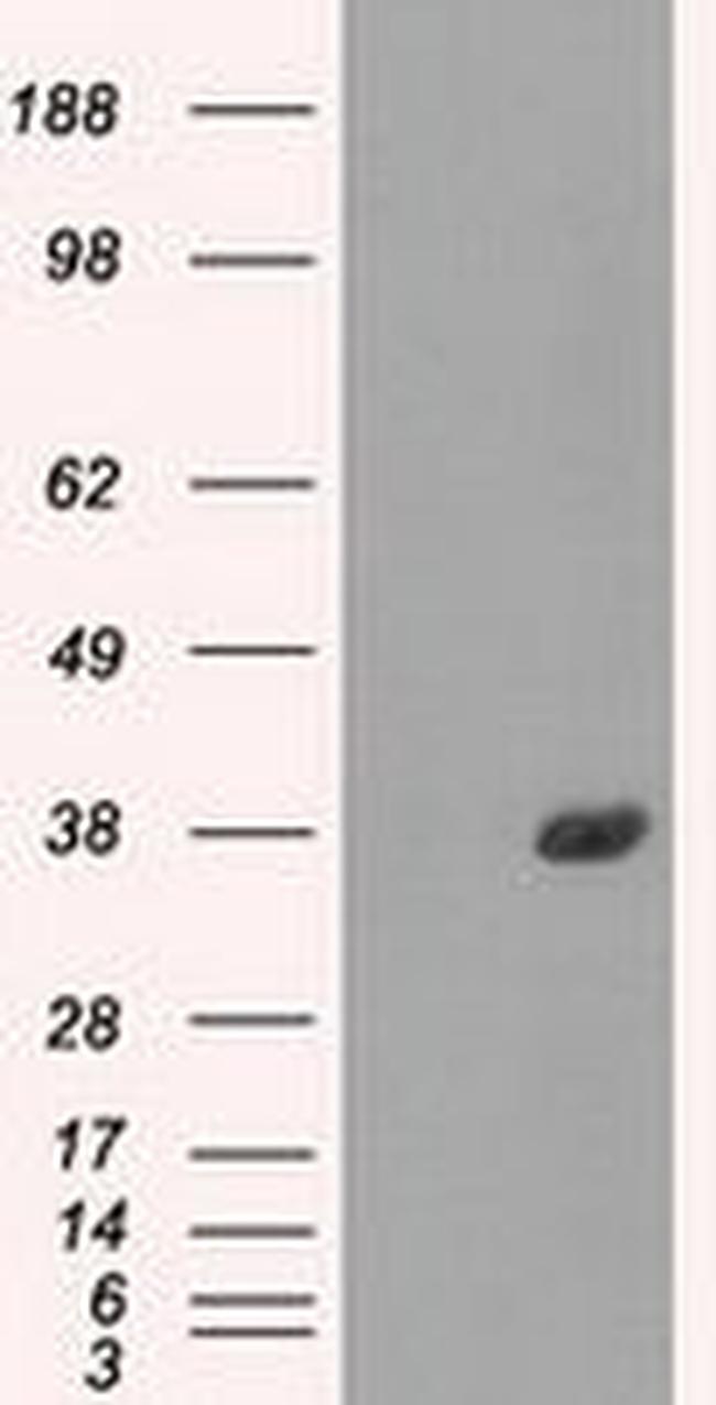 FCGR2A Antibody in Western Blot (WB)