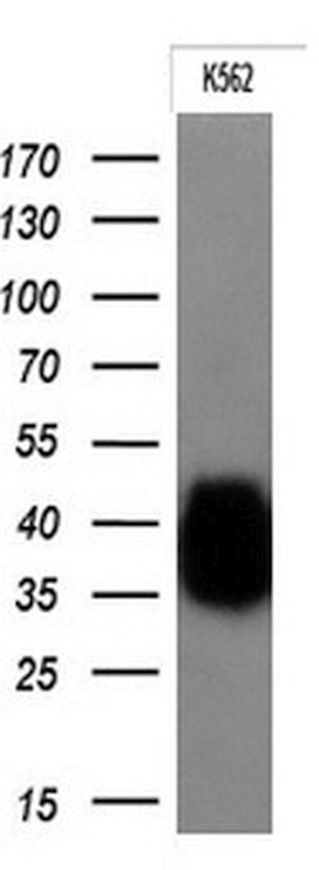 FCGR2A Antibody in Western Blot (WB)