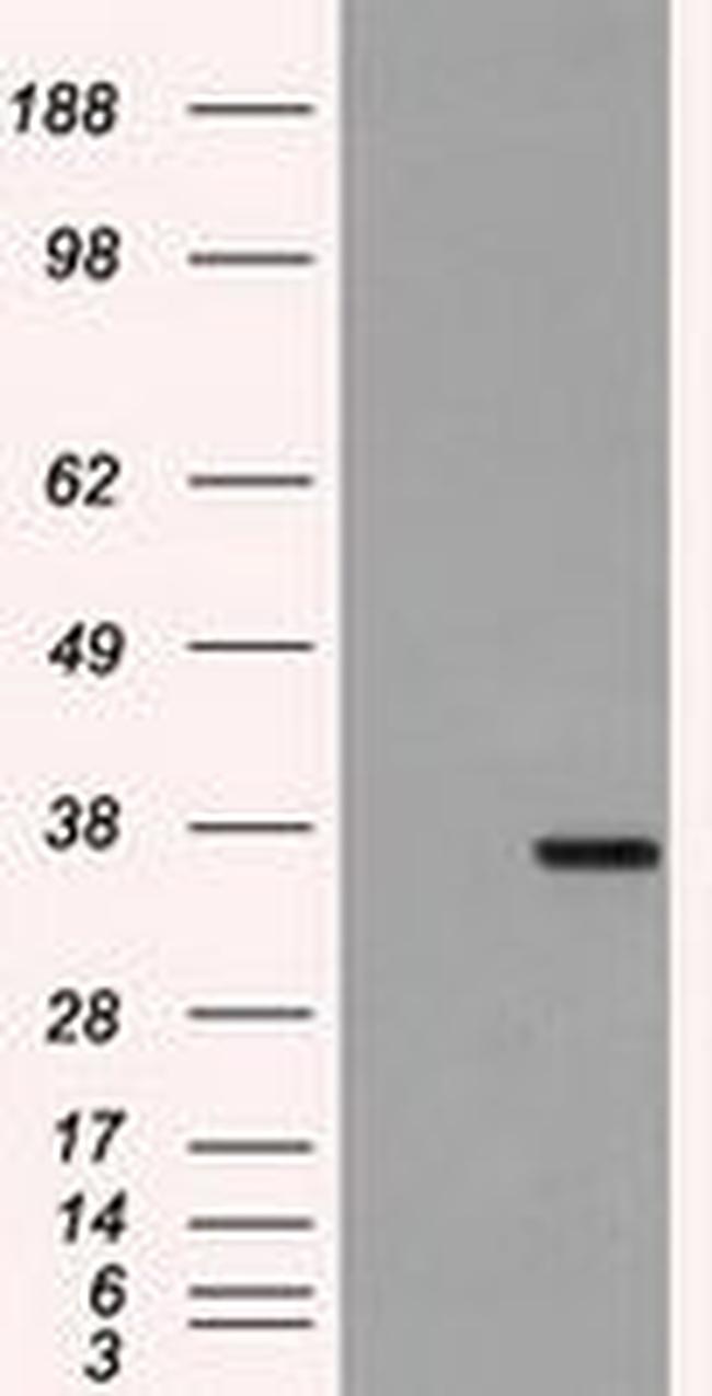 FCGR2A Antibody in Western Blot (WB)