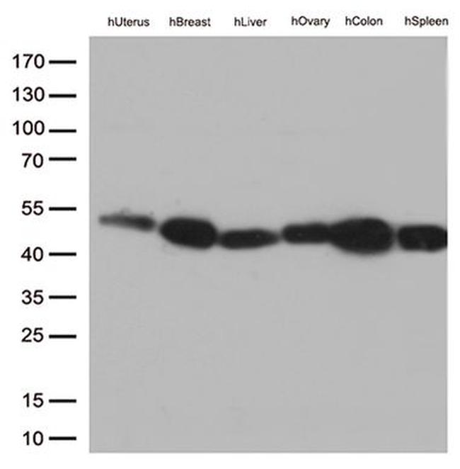 FCGR2A Antibody in Western Blot (WB)