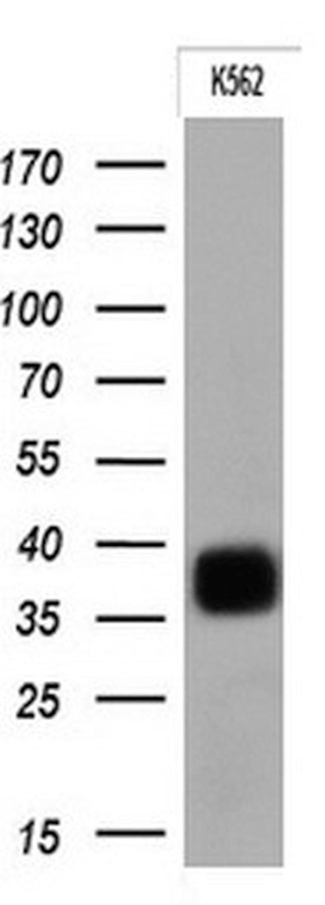 FCGR2A Antibody in Western Blot (WB)