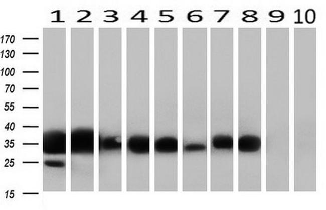 FCGR2A Antibody in Western Blot (WB)