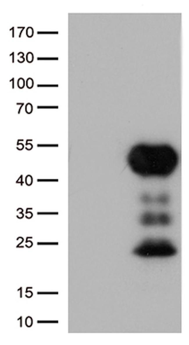 FCGR2A Antibody in Western Blot (WB)