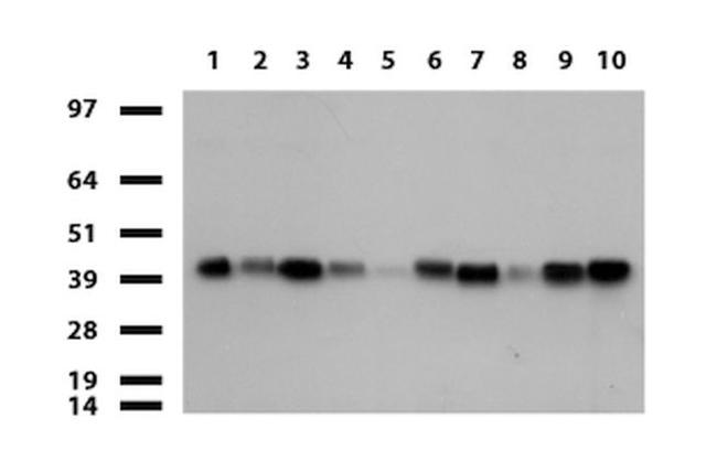 FCGR2A Antibody in Western Blot (WB)