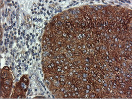 FDFT1 Antibody in Immunohistochemistry (Paraffin) (IHC (P))