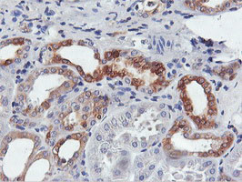 FDFT1 Antibody in Immunohistochemistry (Paraffin) (IHC (P))