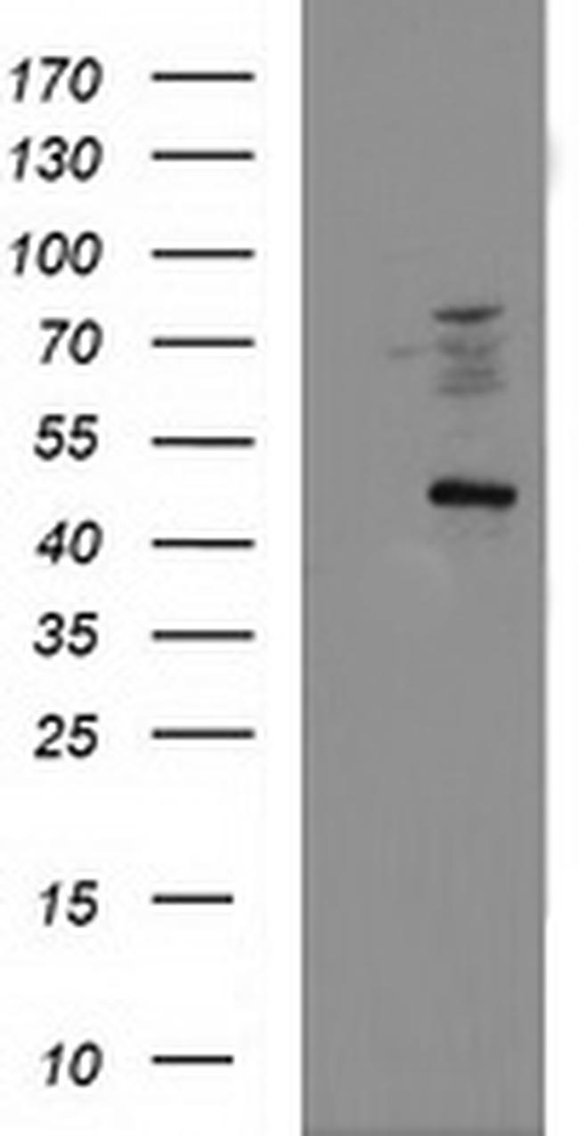 FDFT1 Antibody in Western Blot (WB)