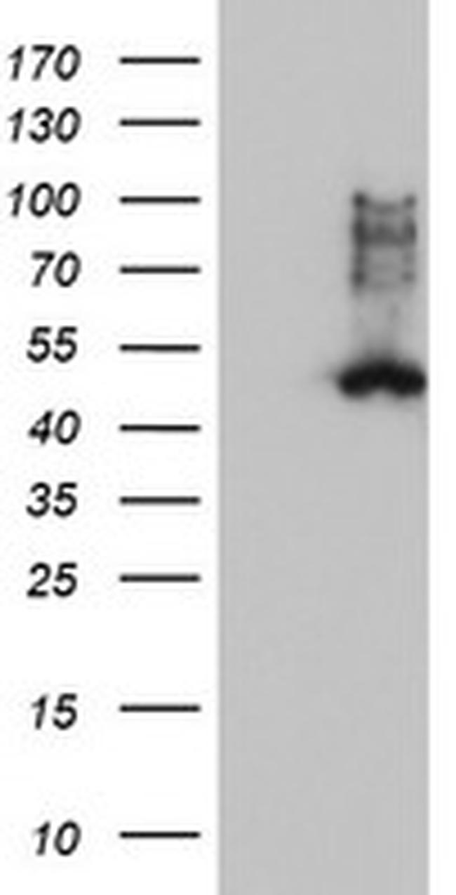 FDFT1 Antibody in Western Blot (WB)