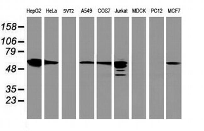 FDFT1 Antibody in Western Blot (WB)